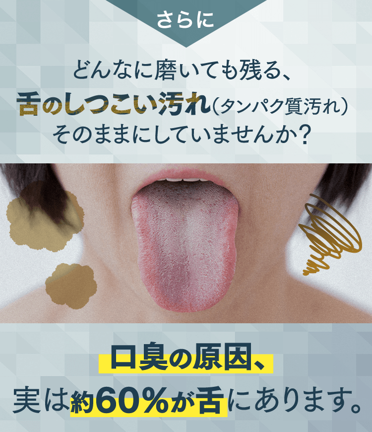 口臭の原因、実は約60%が舌にあります。