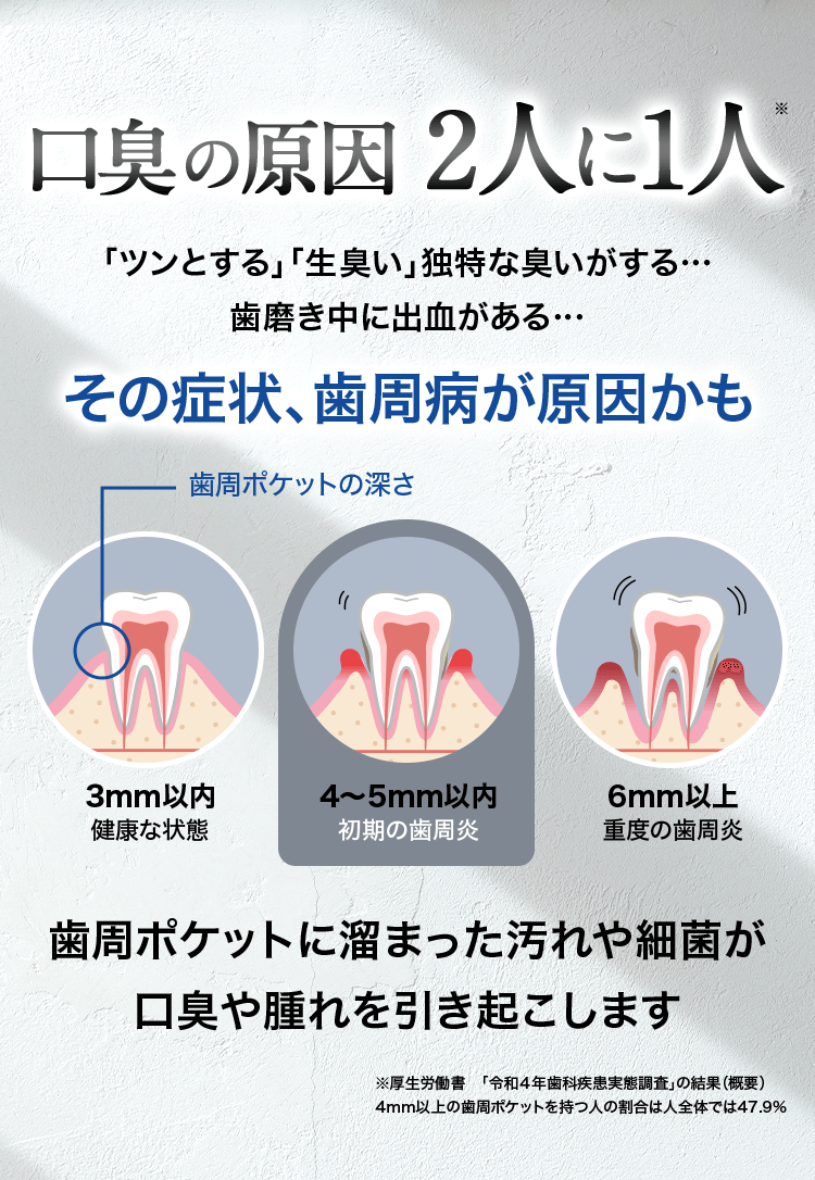 口臭の原因 2人に1人