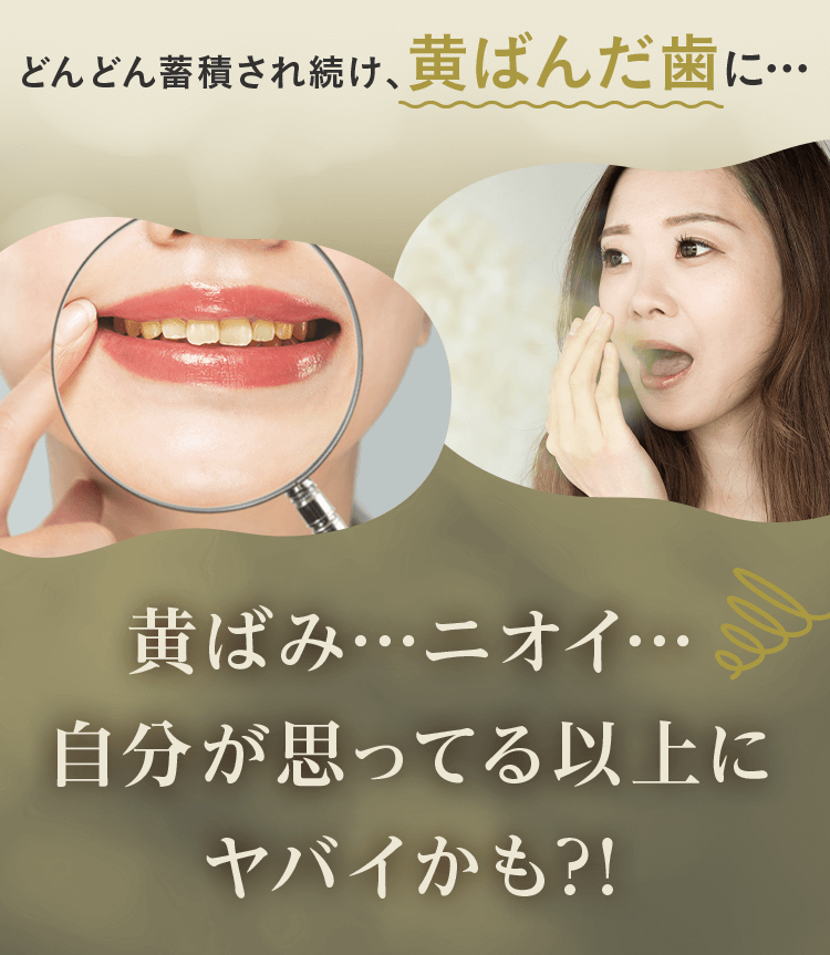 どんどん蓄積され続け、黄ばんだ歯に・・・